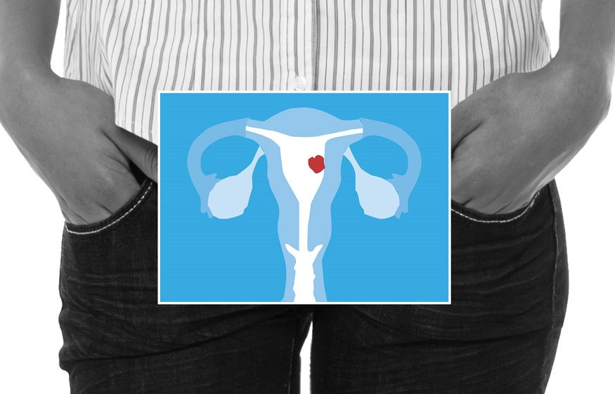 Lenvatinib: Treating Endometriosis effectively